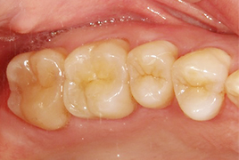 白くて美しい歯なら、大井歯科クリニックはこの辺りのどこの歯科医院にも負けないと自負しております。